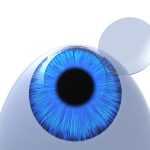 هزینه جراحی لیزیک در سال ۱۴۰۲