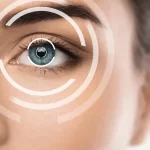 آیا عمل لیزیک برگشت پذیر است؟