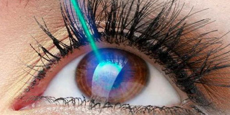 عوارض عمل لیزیک چشم ، حساسیت به نور