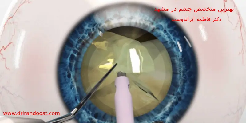 بهترین متخصص چشم در مشهد