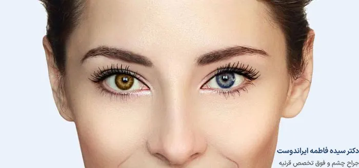 جراحی تغییر رنگ چشم و عوارض آن