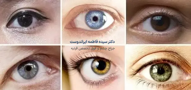 عوارض و خطرات جراحی تغییر رنگ چشم